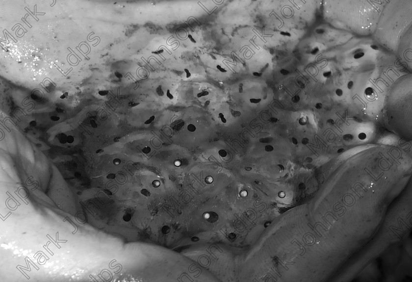 MG 0444 
 Keywords: frog spawn, science, black and white, mono, gel, tadpoles, jelly, frog spawn being held in someones hands